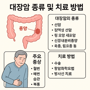 대장암 치료 - 증상부터 최신 면역치료까지 1 대장암 1