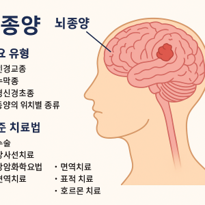 뇌종양 - 증상부터 치료, 생존율까지 총정리 1 뇌종양